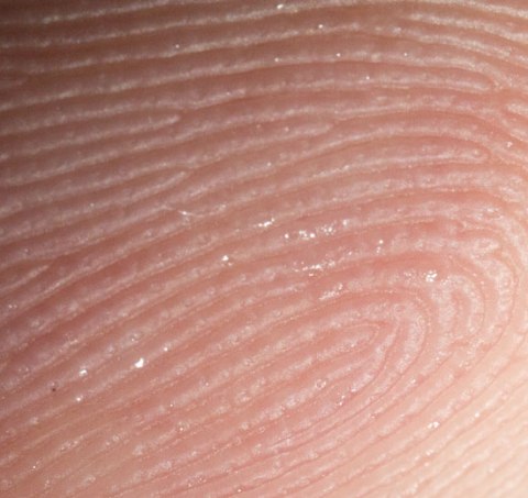 Aluminum-Swarf-Fingertip-Area